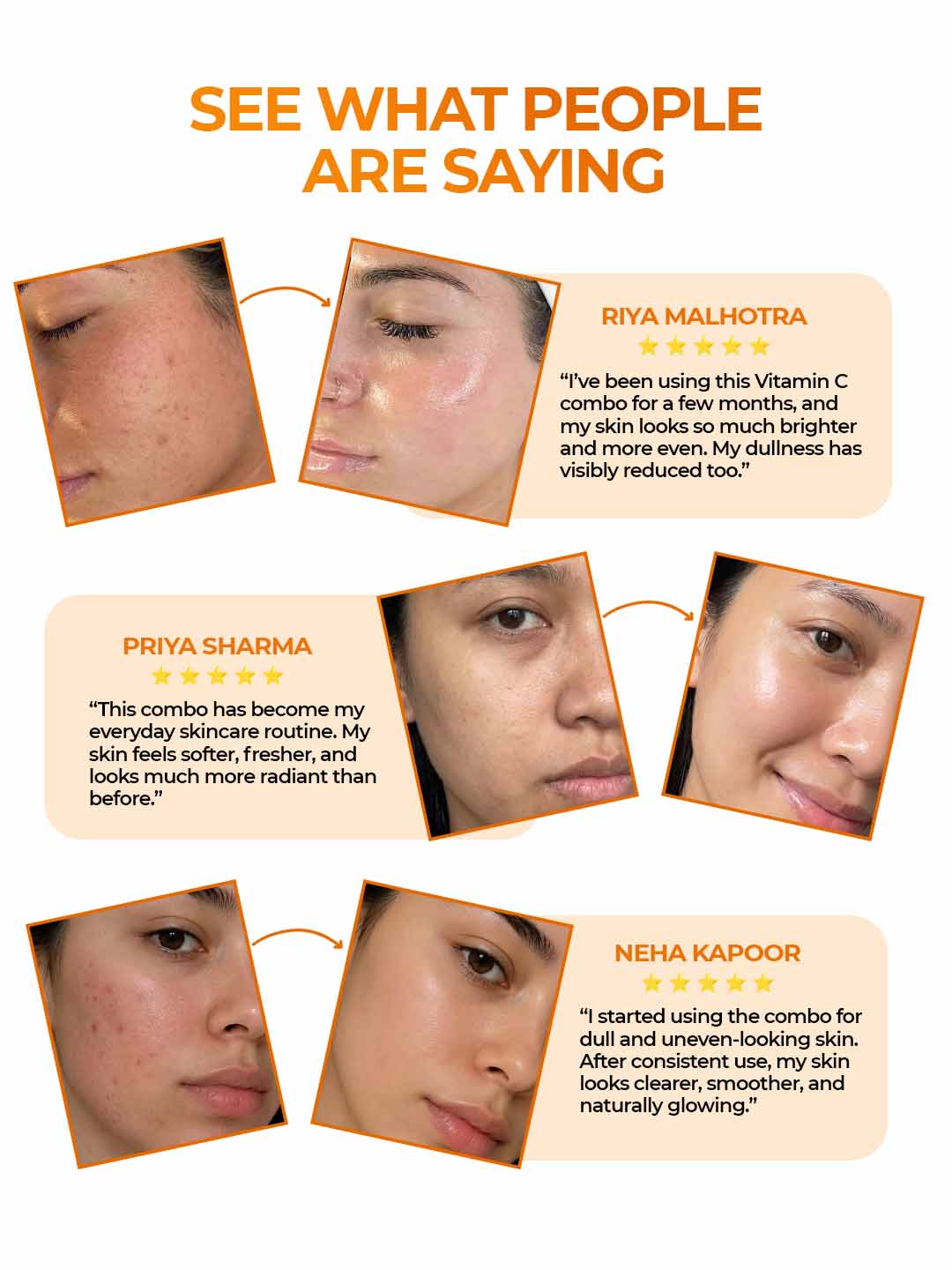 5 Product Daily Brightening Vitamin C Combo - 10% Serum + Moisturizer + Face wash + Soap pack of 3 + Sunscreen