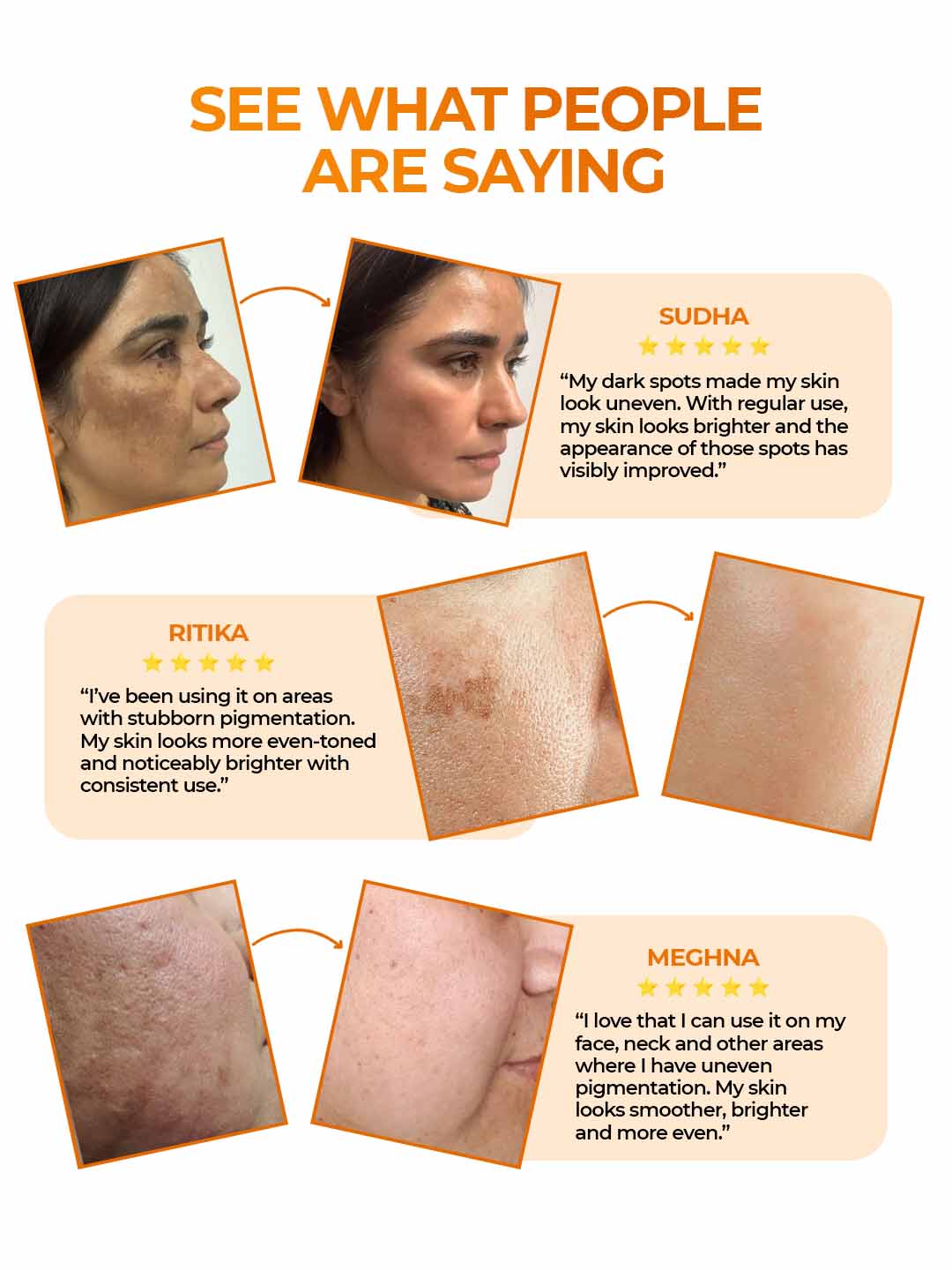 Aquéria Pigmentation Correcting Cream