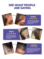 Aquéria Hair Growth Serum Concentrate | 3% Redensyl + 4% Anagain + 2% Baicapil | Hair Fall & Hair Density Support