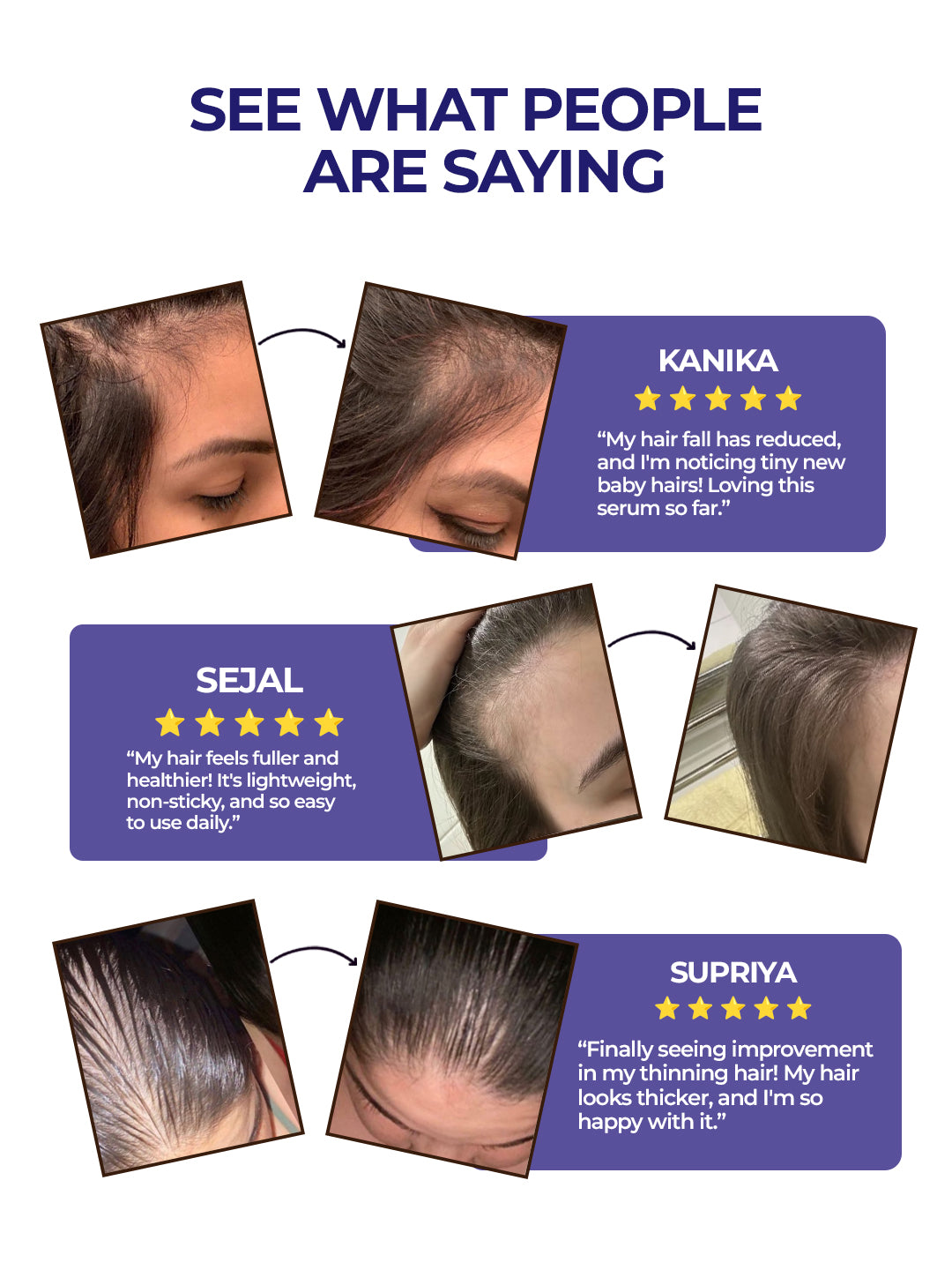 Aquéria Hair Growth Serum Concentrate | 3% Redensyl + 4% Anagain + 2% Baicapil | Hair Fall & Hair Density Support