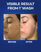 Brightening Body Wash + Underarm Roll on + Brightening French Sunscreen SPF 50 PA++++