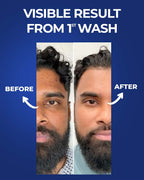 Celebrity Favorite Instant De-Tan Enzyme Peel Shot - Buy 1 Get 1 FREE!