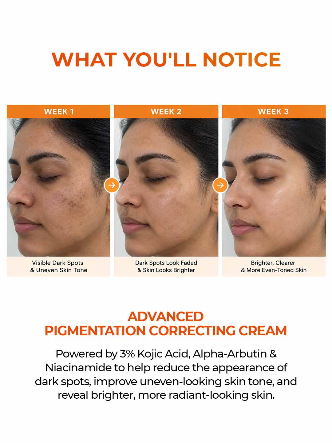 Aquéria Pigmentation Correcting Cream