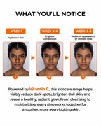 Celebrity Favourite Vitamin C Combo - 10% Serum + Moisturizer + Face wash with FREE ROLL ON!
