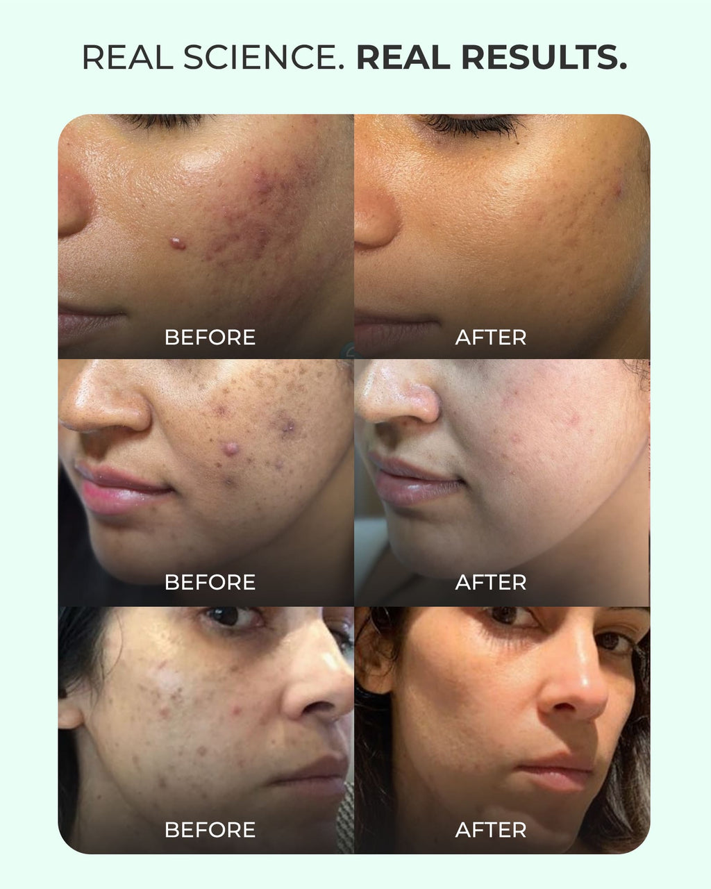 Oil-Control French Face Wash Cleanser