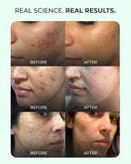 Oil-Control French Face Wash Cleanser