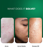 Oil-Control French Gel Moisturizer