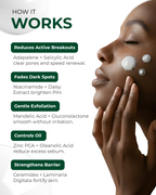 Acne Spot corrector gel