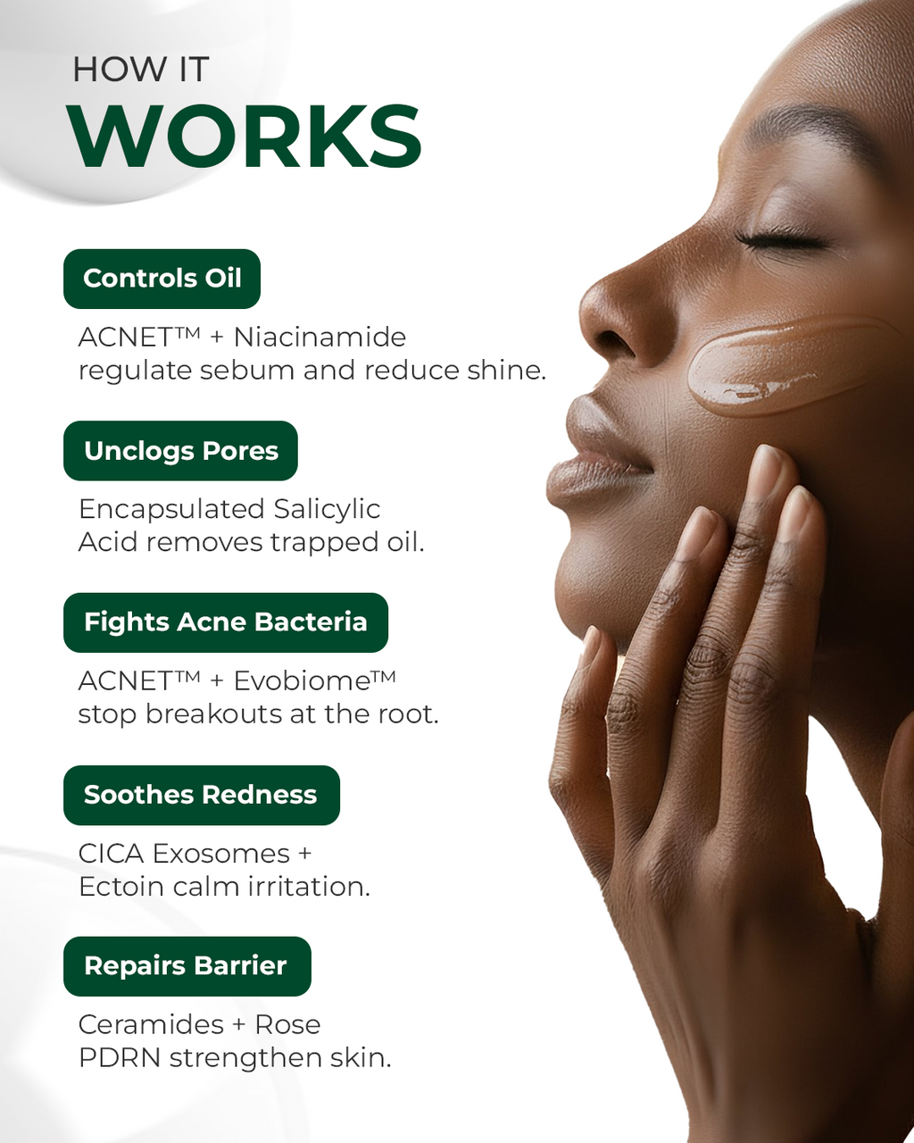 Oil and sebum control Acne Gel Moisturizer