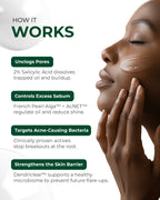 Oil and sebum control Acne Serum