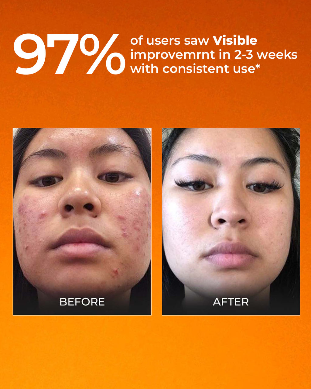 Bestselling Vitamin C Combo - 10% Vitamin C Serum + Vitaminc C Moisturizer + Vitamin C Face wash