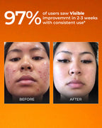 Bestselling Vitamin C Combo - 10% Vitamin C Serum + Vitaminc C Moisturizer + Vitamin C Face wash