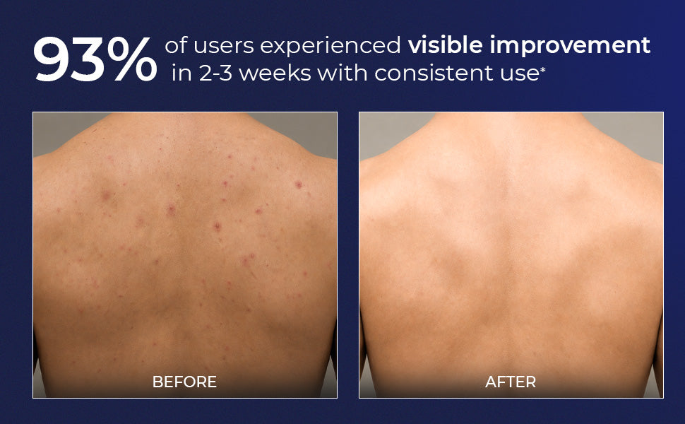 Brightening Body Wash + Instant Enzyme Peel Shot FREE! – Aqueria