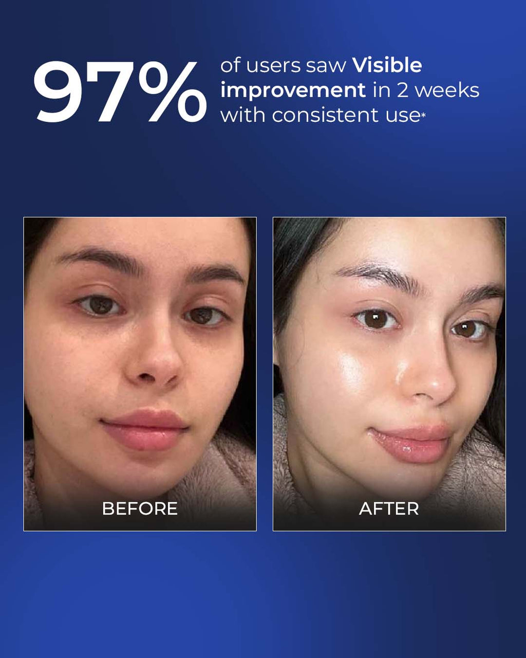 Brightening French Serum for Glow, Dark Spots & Pigmentation