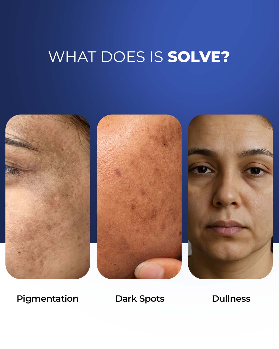 Brightening & Hydrating Multi-Active French Serum