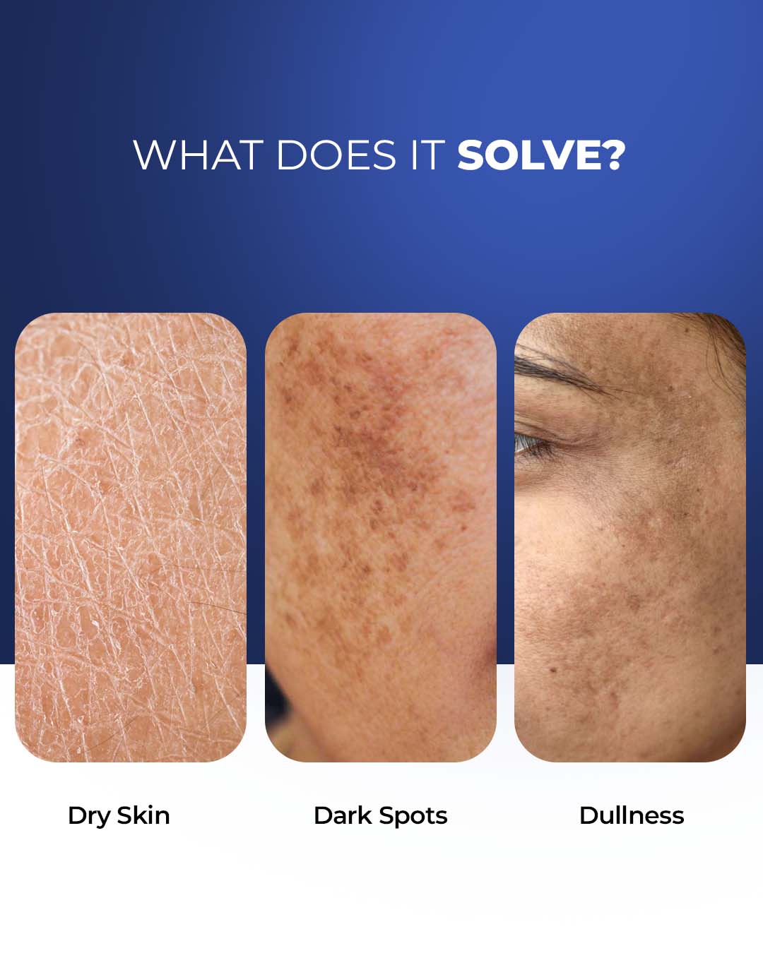 Brightening & Hydrating Moisturizer | 3% Niacinamide | Alpha Arbutin | Vitamin B5