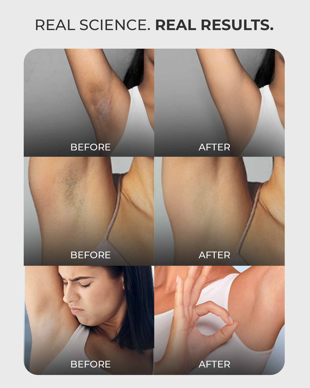 Multi-Active Underarm Treatment Roll-On | 5.5% AHA BHA | Niacinamide | Zinc Ricinoleate - French Flora Pack of 2