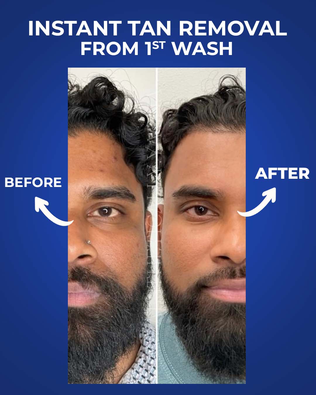 Brightening Body Wash + FREE Instant Enzyme Peel Shot + FREE Underarm Roll On