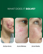 Advanced Multi-Active French Spot Corrector