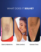 Multi-Active Underarm Treatment Roll-On | 5.5% AHA BHA | Niacinamide | Zinc Ricinoleate - French Flora Pack of 2