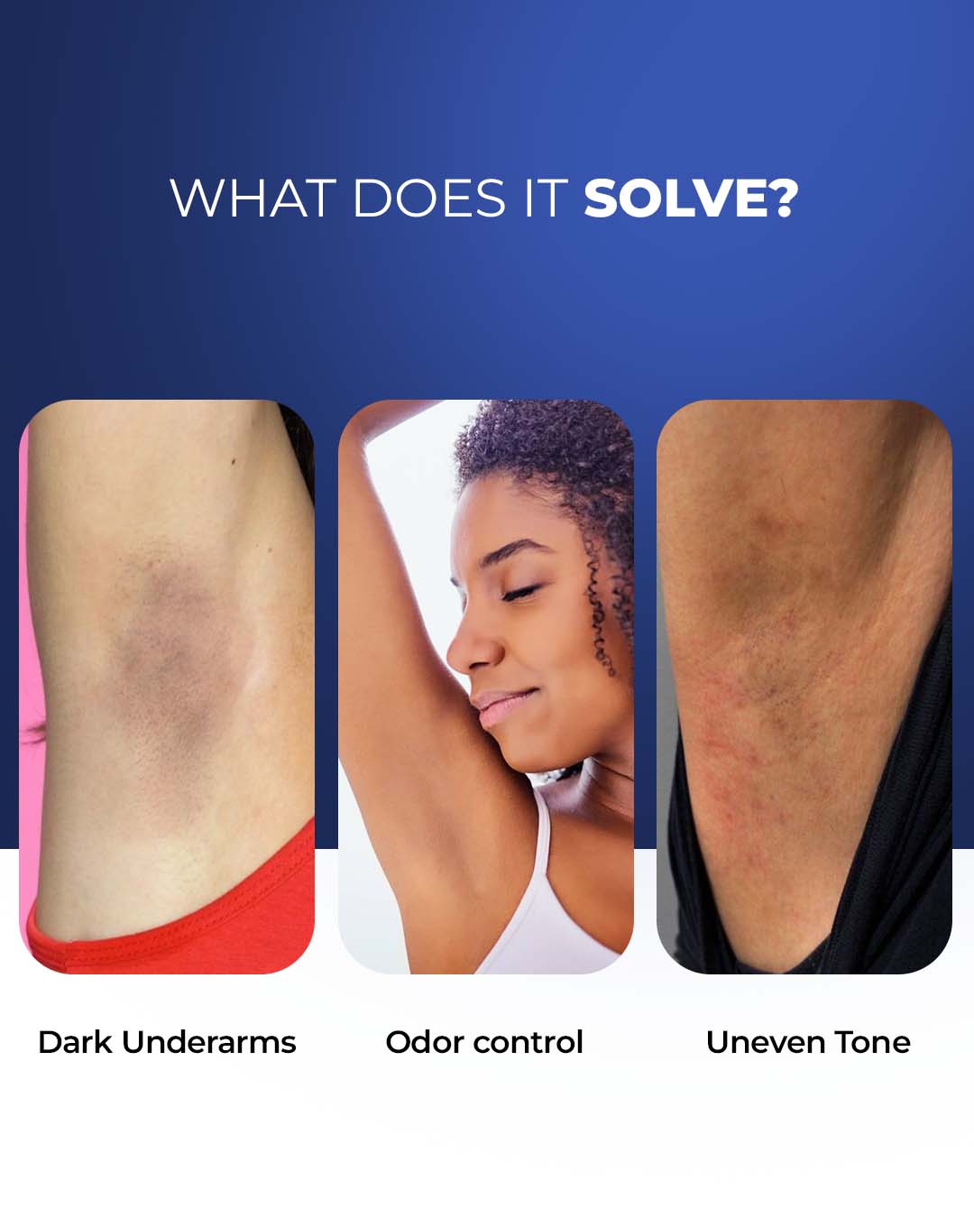 Multi-Active Underarm Treatment Roll-On | 5.5% AHA BHA | Niacinamide | Zinc Ricinoleate - French Flora Pack of 2