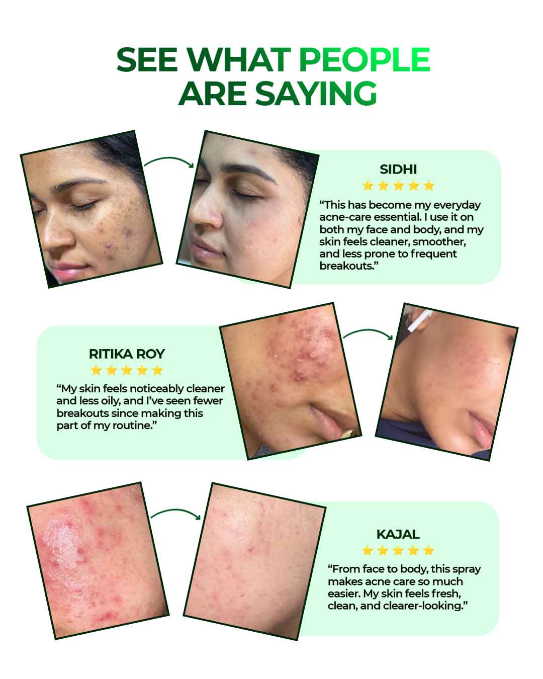 Acne Clearing Face & Body Spray with Salicylic Acid, Benzoyl Peroxide & Zinc PCA | For Back & Body Breakouts | Fast-Drying 360° Spray